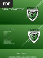 Craniossinostose