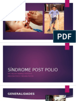 Síndrome Post Polio