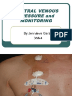 Central Venous Pressure Report