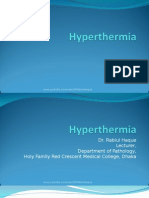 hyperthermia