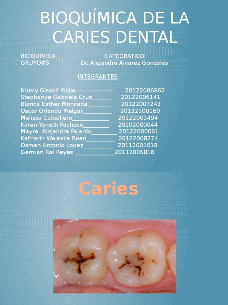 Bioquimica de Caries Dental Diente humano Química
