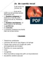 Parálisis cuerdas vocales: causas, síntomas y tratamientos