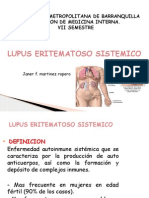 Lupuseritematososistemico 120305054527 Phpapp02