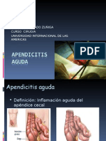 Apendicitis