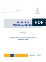 Insuficiencia Venosa de Extremidades Inferiores