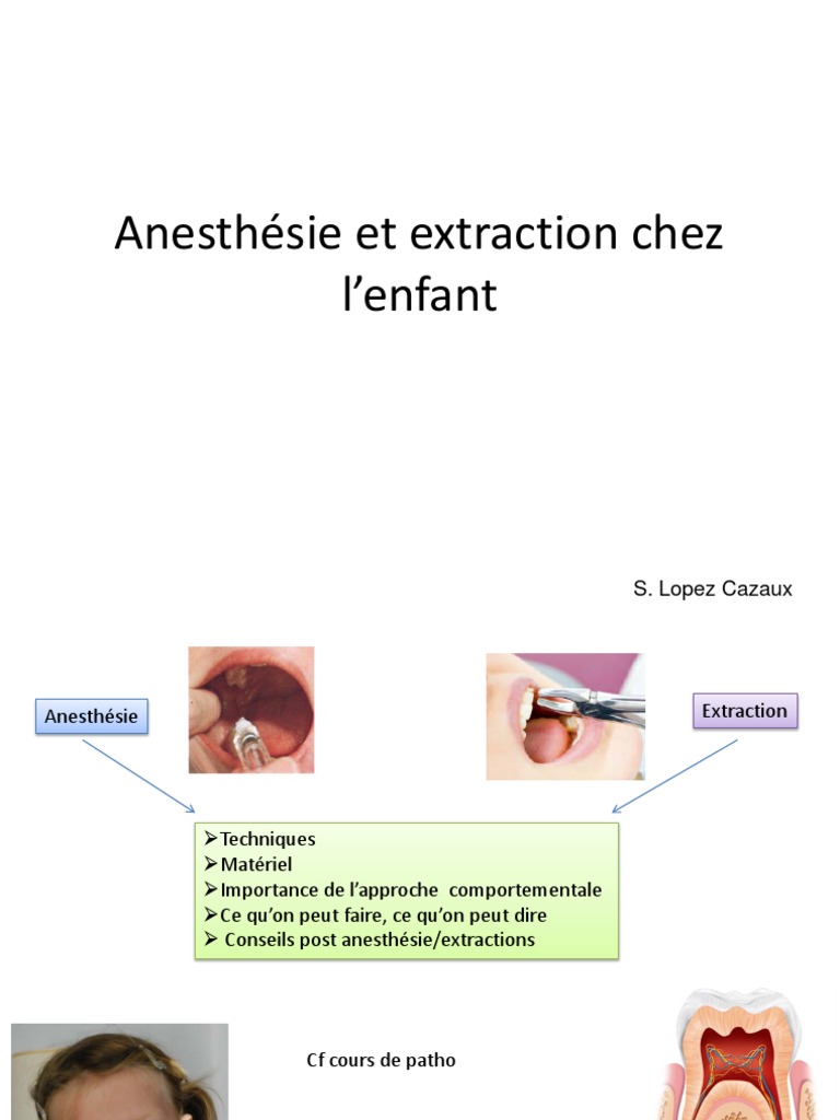 Anesthésie Et Extraction Chez L'enfant PDF Douleur Anesthésie — free download
