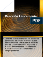 Reacción Leucemoide1
