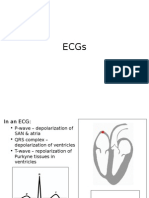 ECGs