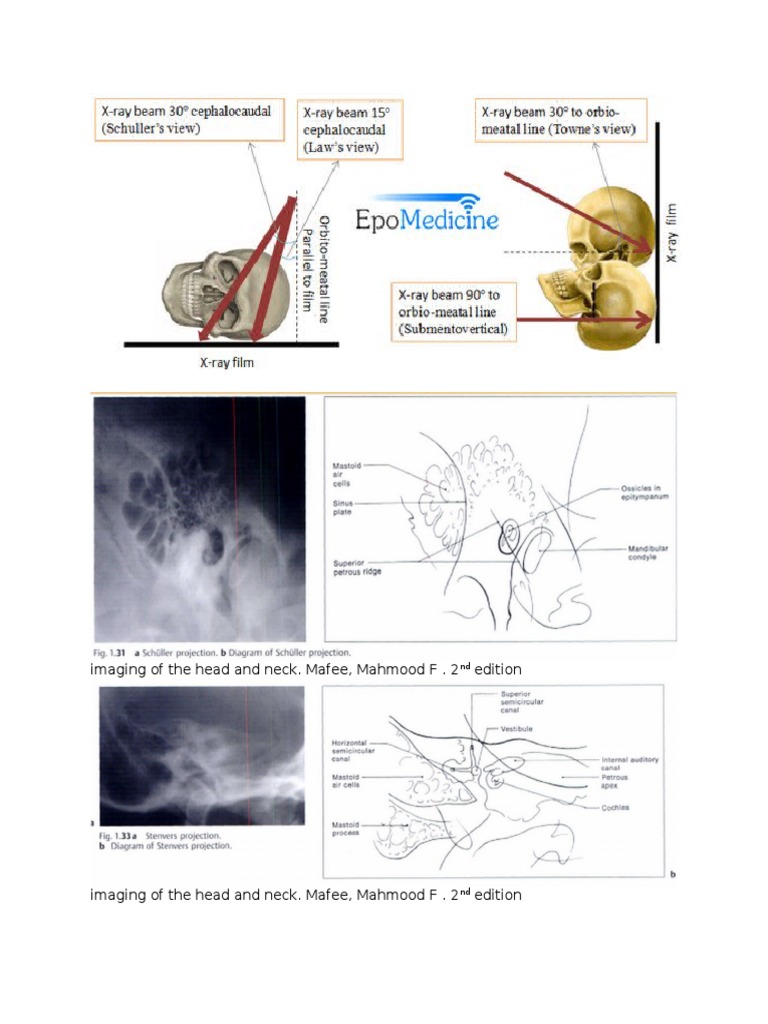 Imaging of The Head and Neck. Mafee, Mahmood F - 2 Edition | PDF