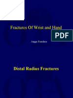 Fracture Around Wrist