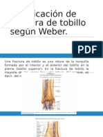 Clasificación de Fractura de Tobillo Según Weber. Karla Citlaly Hernandez Quinatanar.