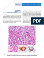 Journal of Clinical Oncology Volume 31 Issue 5 2013 [Doi 10.1200%2FJCO.2012.43.2377] Menon, M. P.; Hutchinson, L.; Garver, J.; Jaffe, E. S.; Woda, B. -- Transformation of Follicular Lymphoma to Epstei