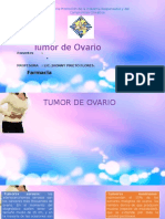 Tumor de Ovario1