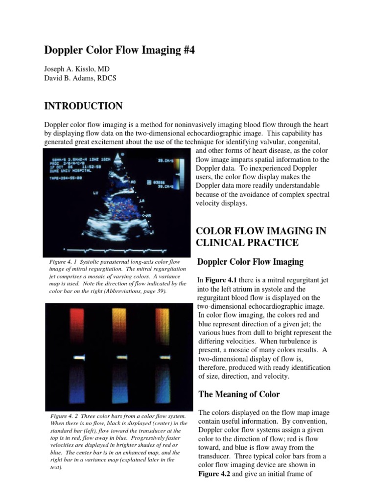 Doppler 04 | PDF