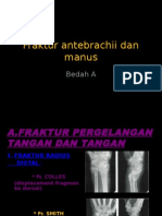 Fraktur Antebrachii Dan Manus
