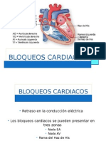 Bloqueos cardiacos: tipos y características en EKG