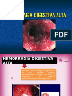 Hemorragia Digestiva Alta