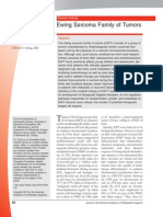 Sarcoma de Edwing