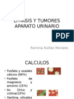 Litiasis y Tumores Aparato Urinario