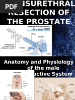 Download Transurethral Resection of the Prostate by ralf_dolan SN26611990 doc pdf