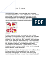 Tinjauan Pustaka Sinusitis