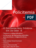 Policitemia Vera