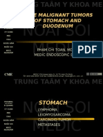 Noäi Soi Medic: Rare Malignant Tumors of Stomach and Duodenum
