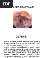 Download VARISES ESOFAGUS by FridaZoraya SN266511131 doc pdf