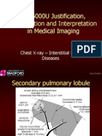 CXR Interstitial Lung Disease 2014