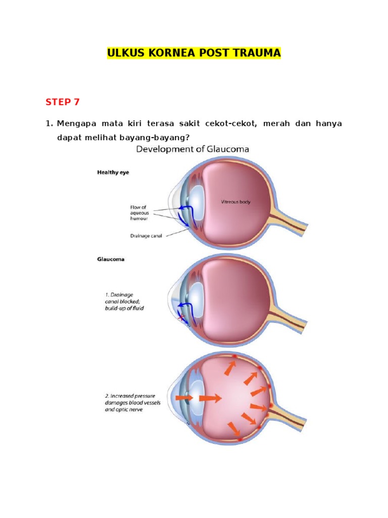 Melihat Dengan Mata Dikecilkan Karena Silau Berbagai Mata