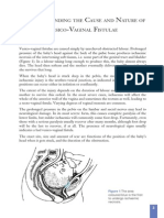 Vesicovaginal Fistula PDF