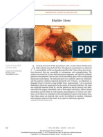 Bladder Stone: Images in Clinical Medicine