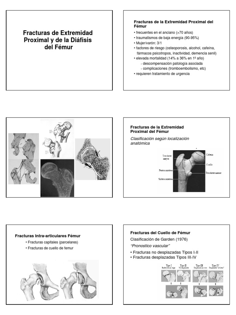 Fractura Femur Proximal Sistema Esqueletico Medicina