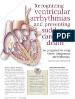 Ventricular Arrhythmias