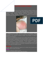 Celulitis Infecciosa