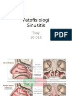 Patofisiologi Sinusitis