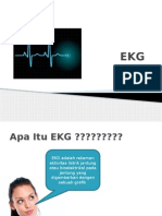 EKG 1