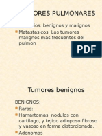 Tumores Pulmonares: Primarios: Benignos y Malignos Metastasicos: Los Tumores Malignos Más Frecuentes Del Pulmon