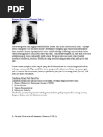 Download GambarFotoThoraxbyAntaSiregarSN267187577 doc pdf