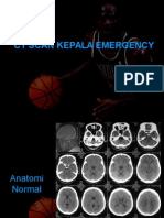 Download CT Scan Kepala Emergency by Yessy SN267207306 doc pdf
