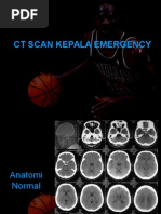 Download CT Scan Kepala Emergency by Yessy SN267207306 doc pdf