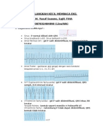 7 LANGKAH Membaca EKG Singkat