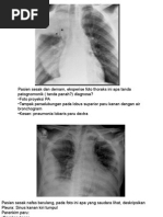 Hasil Rontgen Genu dan Cruris Normal | PDF