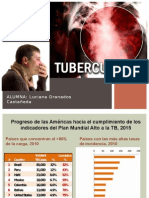 Tuberculosis