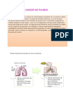 Cáncer pulmonar