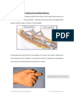 Lesiones de Los Tendones Flexores