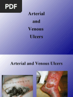Download 4 - arterial  venous ulcers by charity kalinowsky SN2674706 doc pdf