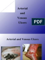 4 - Arterial & Venous Ulcers