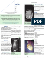 Caso Clinico Hidatidosis