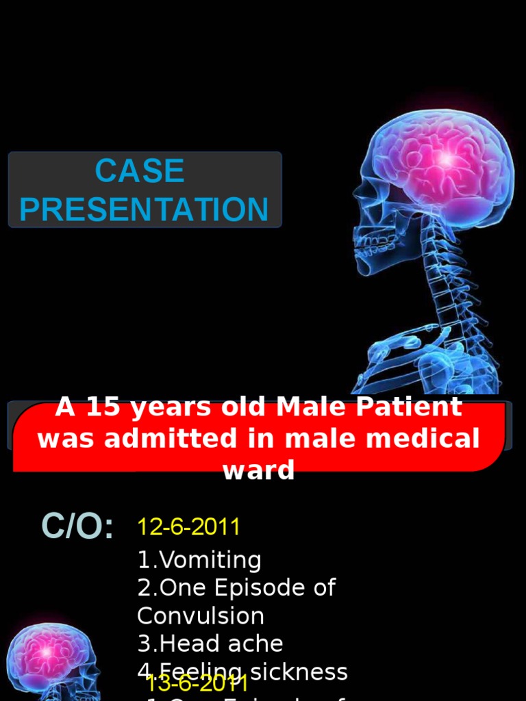 Epilepsy patient case study image